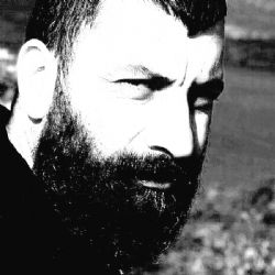 Özgür Tüzer&nbsp;Hasarlıyım